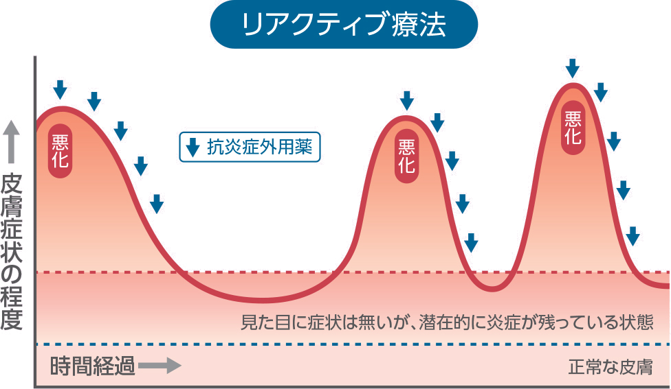 リアクティブ療法