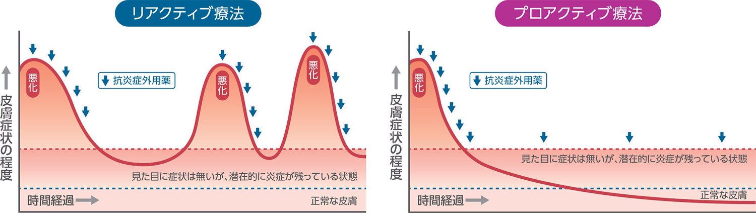 リアクティブ療法とプロアクティブ療法